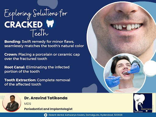 Treatment Options for a Cracked or Fractured Tooth post image