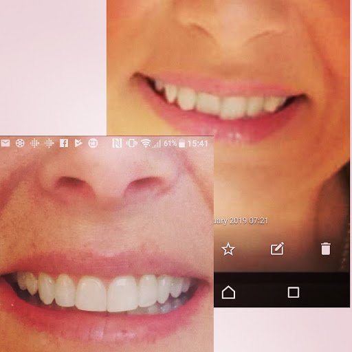 Wolds Dental Studio - Thumbnail
