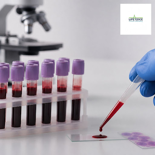 Feeling tired, weak, or dizzy too often? It could be anemia. At Life Edge Clinical Laboratory in… post image