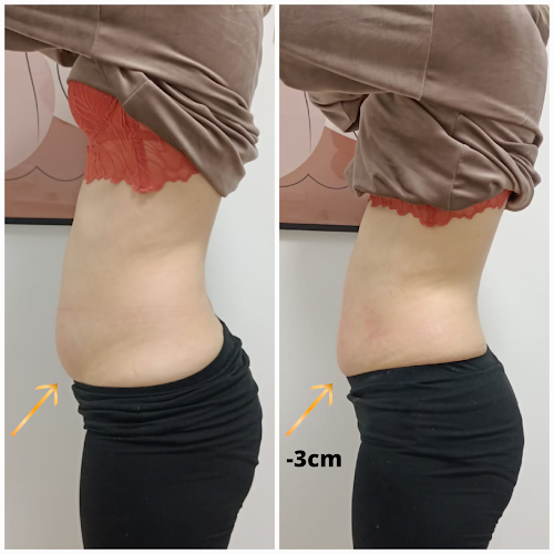 Komentarze i opinie o Calisia Medical SPA | Salon Kosmetyczny |