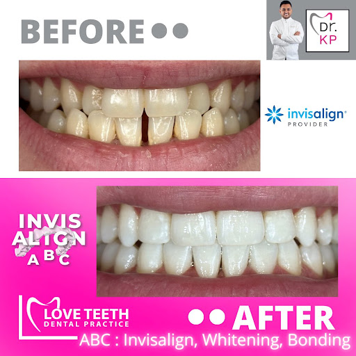 Love Teeth Dental - Stonecot - Thumbnail