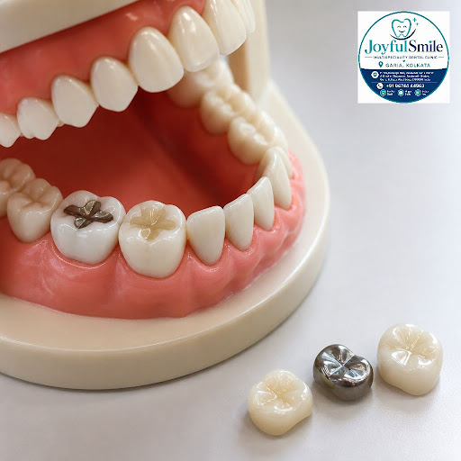 Worried that your old fillings may not last? At Joyfulsmile multispeciality dental clinic in Kanu… post image