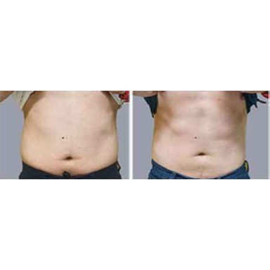 Euphoria Aesthetics & Laser photo 29