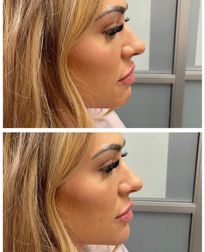 KC Injectables Med Spa