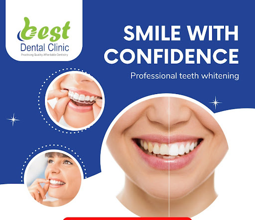 Our dental clinic is offering professional teeth whitening services at affordable cost. We are of… post image