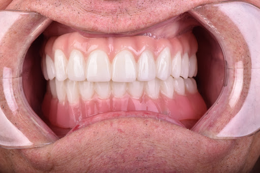 Miracle Smile Dentistry - Dr. Anna Aller - Thumbnail