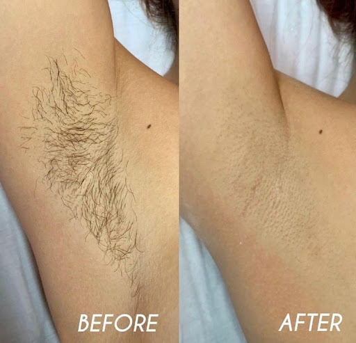 London laser&beauty studio