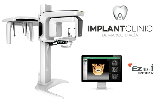 Dr. Marco Maciá Implant Clínic Benijofar - Thumbnail