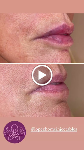 Lopez home injectables