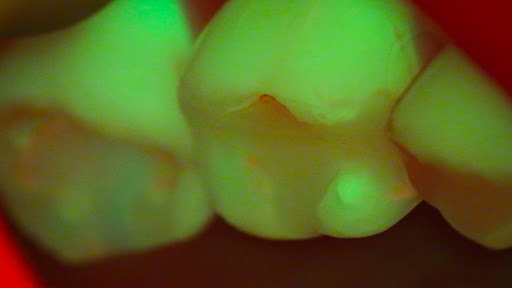 Zahnarzt - Costin Marinescu, Dr-Medic Stom, DDS - Advanced Aesthetic and Preventive Dentistry - Thumbnail