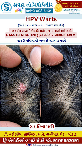 🚨 બાળકના માથામાં થયેલો ચેપી મસો (HPV Warts) કાપકૂપ વગર માત્ર ૩ મહિનામાં જડમૂળથી ગાયબ 🌱✨