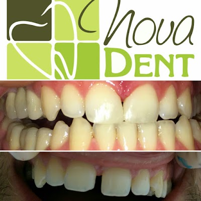 Klinike Dentare Nova Dent (Dr. Ela Dragoti)