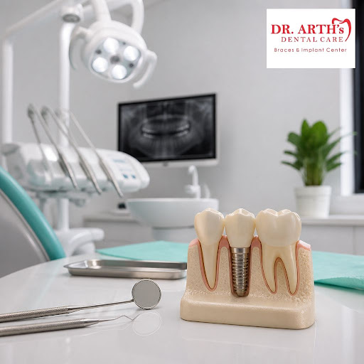 Worried that dental implants will be painful or complicated? At Dr Arths Dental Care Braces & Imp… post image
