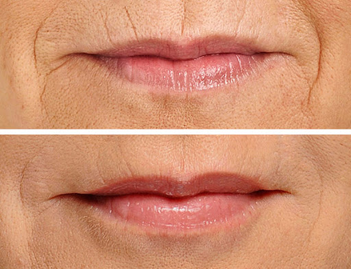 Bay Area Cosmetic Dermatology