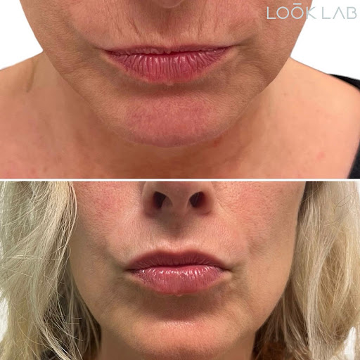 Look Lab Med Spa