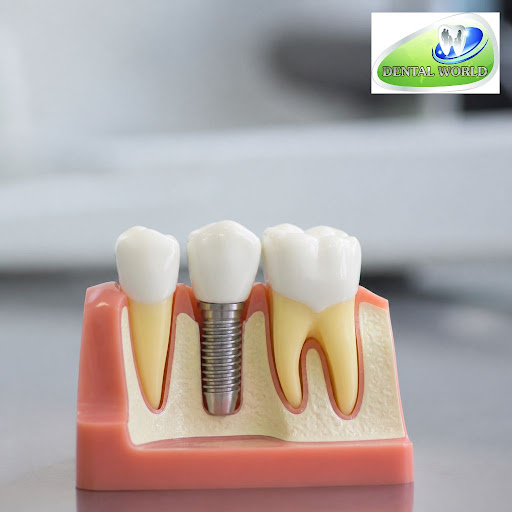 Missing teeth can make it hard to smile confidently, chew properly, and speak clearly. At Dental… post image