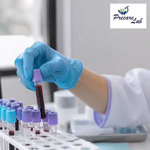 Accurate reports start long before your sample reaches the machine. At Precare Lab in Sector 86,… post image