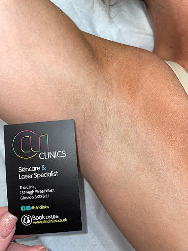 CLN Clinics