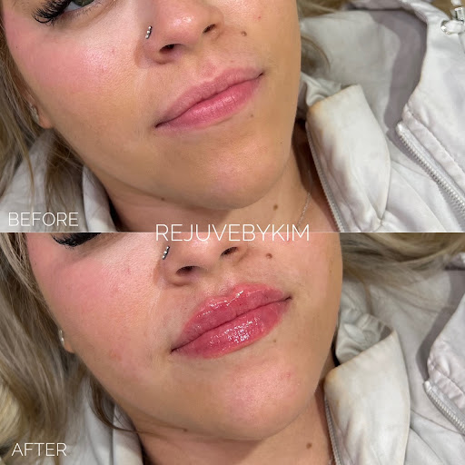 RejuveByKim Med Spa