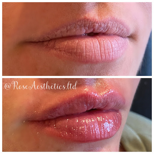 Rose Aesthetics Ltd - Thumbnail