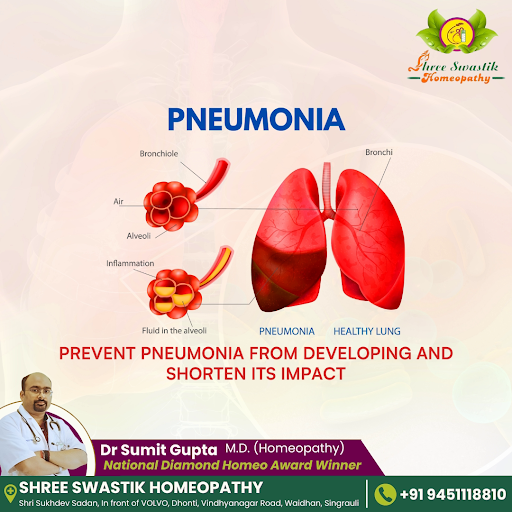 Prevent pneumonia before it starts!Taking proactive measures can help reduce your risk and shorte… post image