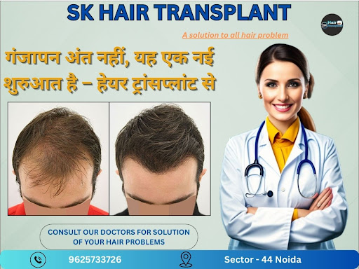 Are you struggling with hair loss or baldness? Visit SK Hair Transplant Clinic in Sector 44, Noid… post image