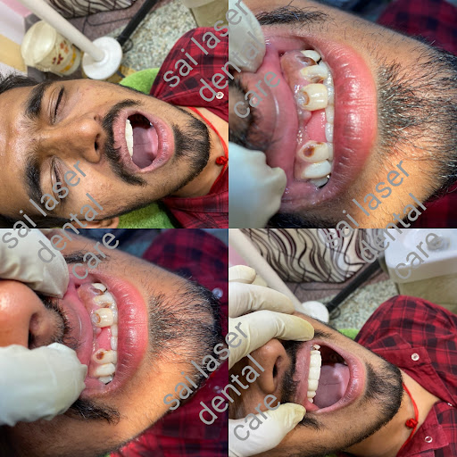 Dental bridge.. post image