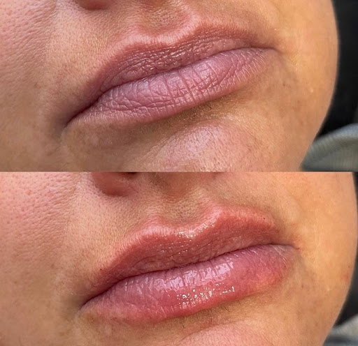 Blossom Med Spa, York