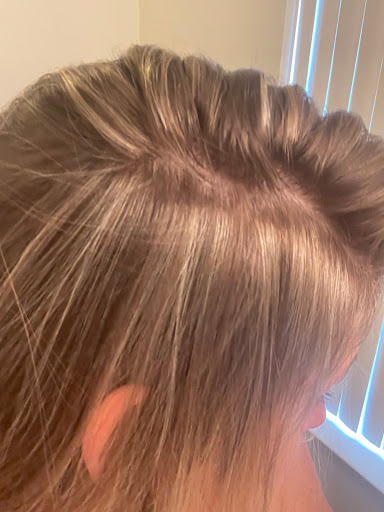 Frizzles of Alexandria - Thumbnail