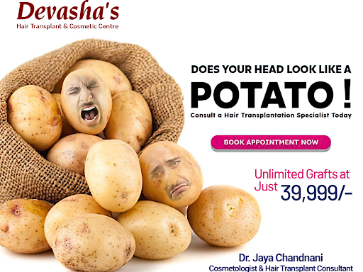 Unlimited Grafts - Best Price - Just 39999/- post image
