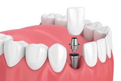 Oakley Oral Surgery - Richard M. Oakley