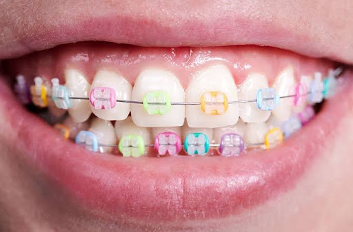 BlackDental Clínica Dental Suc. Tampico - Thumbnail