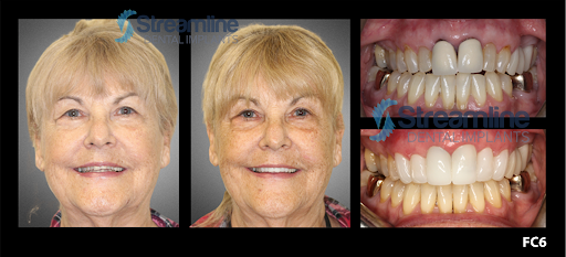 Bird Rock Dental La Jolla - Thumbnail
