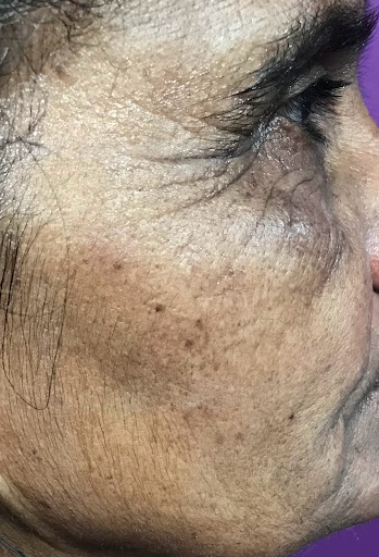 Define Brows Bletchley Milton Keynes - Thumbnail