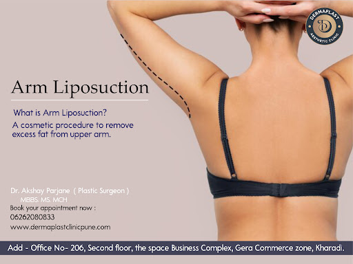 Arm Liposuction Surgery in Kharadi, Pune 