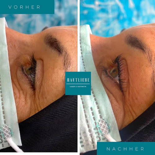 Hautliebe Laser & Aesthetik Wuppertal photo