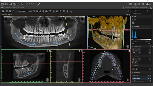 Meditec Dental - Installateur cabinet dentaire, radiologie et informatique 13 Marseille - Thumbnail