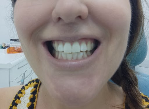Clínica Dental Lucident - Thumbnail