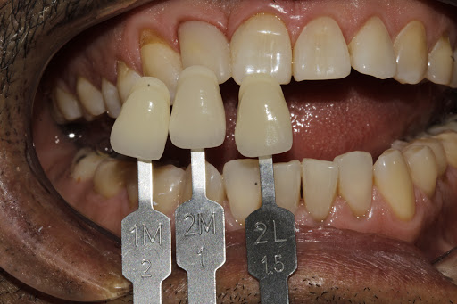 RP Dental Office SMA Gallery - Mexico