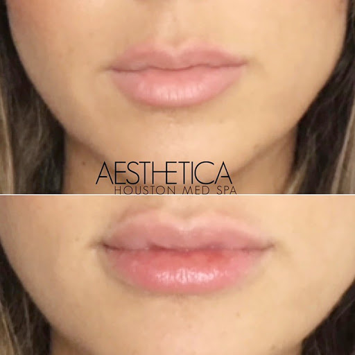 Aesthetica Houston Med Spa - Thumbnail