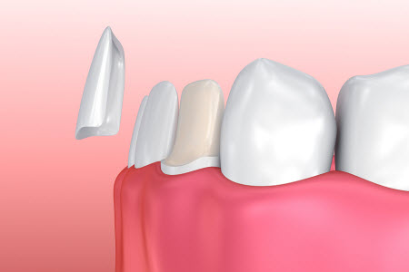 Chiswick Dental Care Open Times