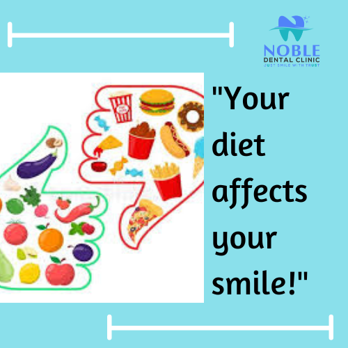 Did you know that what you eat has a significant impact on your oral health? A balanced diet not… post image