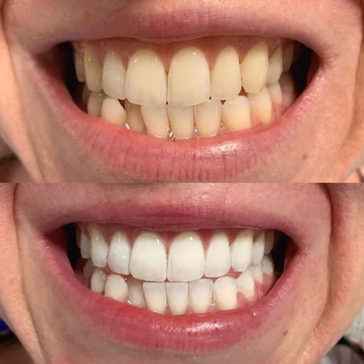 Pure Smile Townsville - Thumbnail