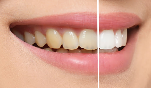 Dentist Vendrell
