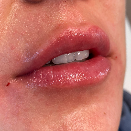 Cheeky Medspa - Soldotna (kenai)