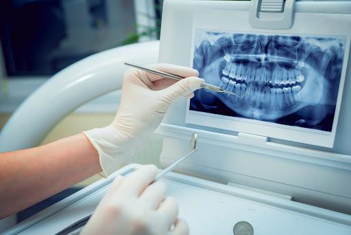 Studio Dentistico Panella - Thumbnail