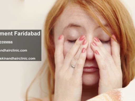 Kara Skin And Hair Clinic is the best option for #Xanthelasmatreatmentfaridabad at affordable cos… post image