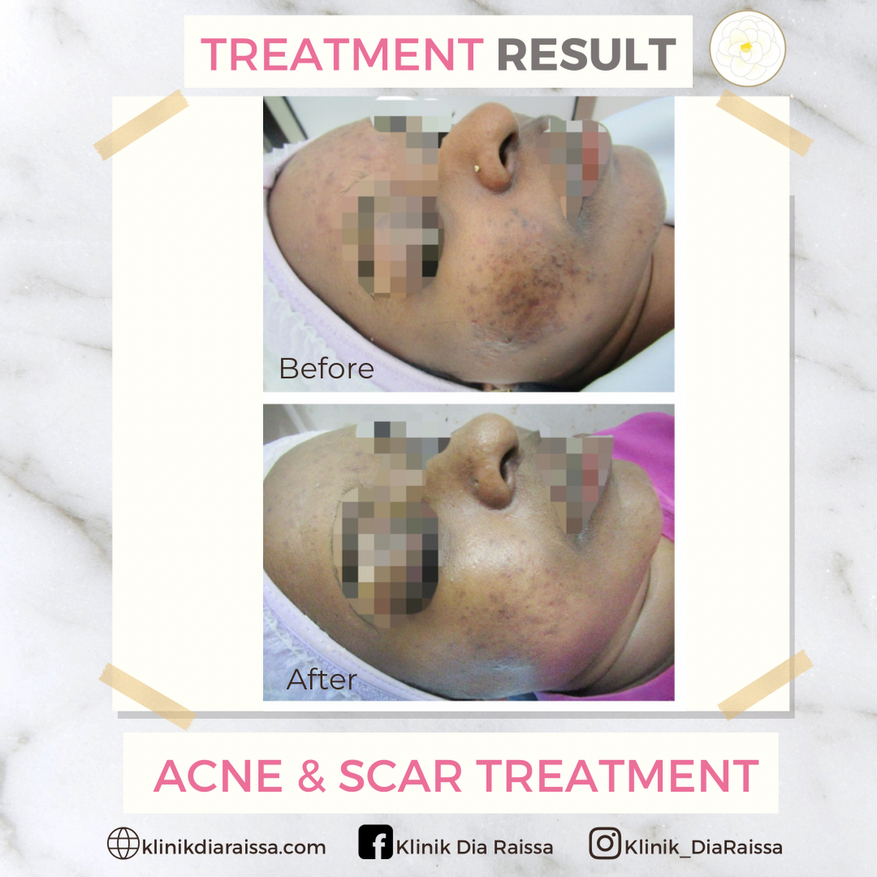 Klinik Dia Raissa Skin Care Clinic In Seremban