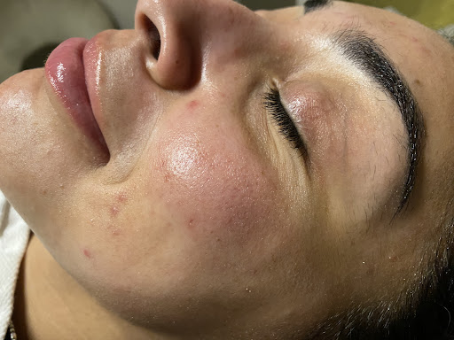 Piel de Miel Skincare - Thumbnail