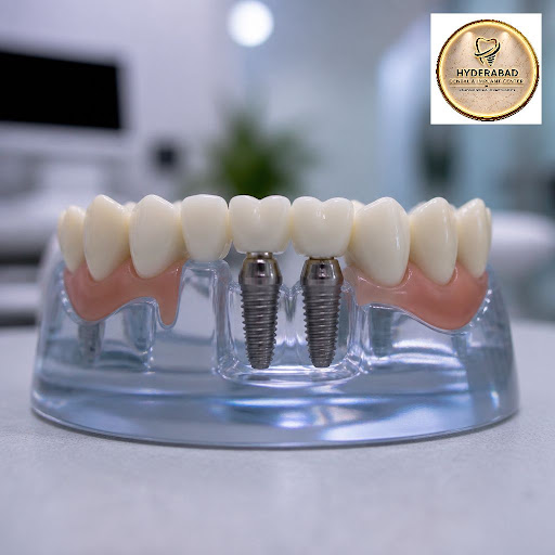 Waiting for your dental implants to heal doesn’t mean you have to live with gaps in your smile. A… post image